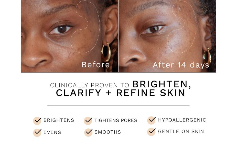 REN Clean Skincare Ready Steady Glow Daily AHA Tonic 250ml - Image 7