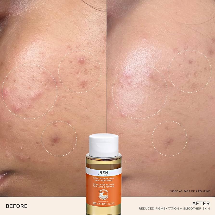 REN Clean Skincare Ready Steady Glow Daily AHA Tonic 250ml - Image 5