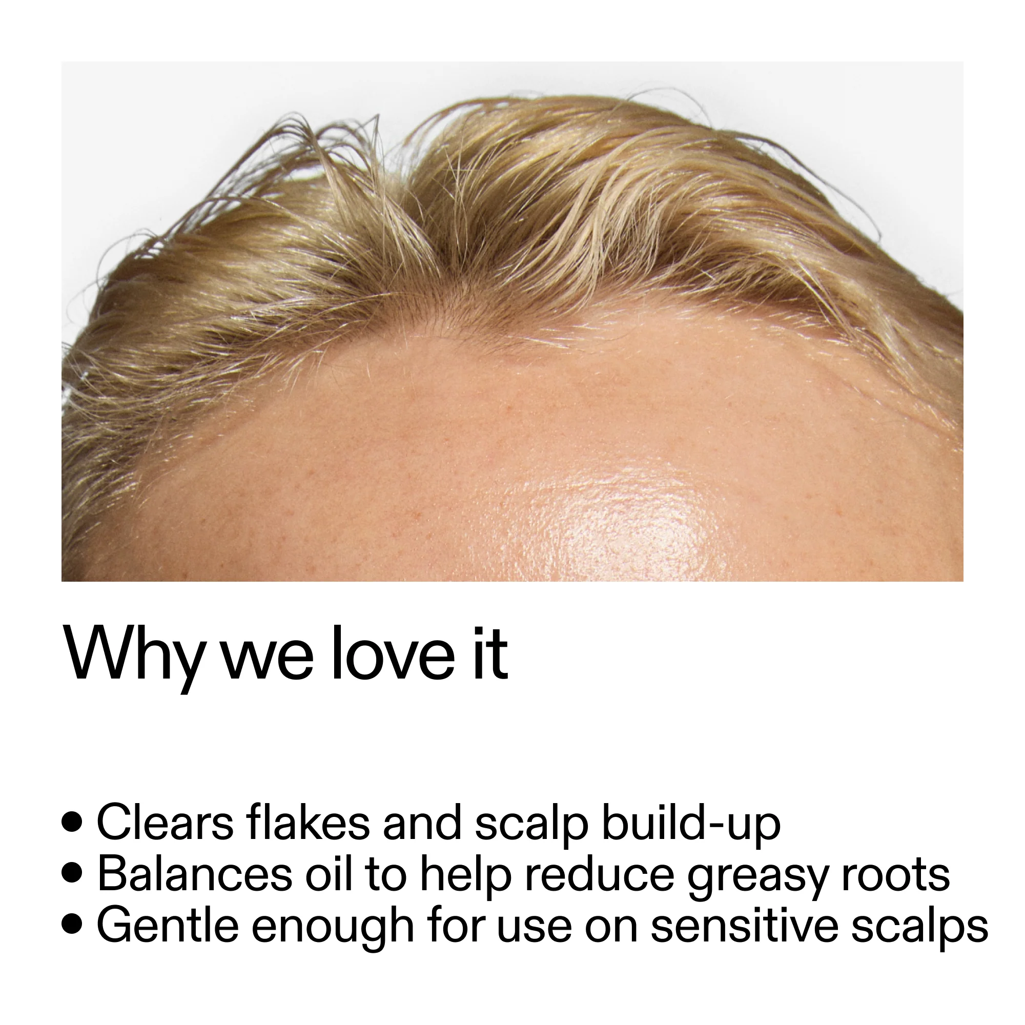 The INKEY List Salicylic Acid Exfoliating Scalp Treatment - Image 3