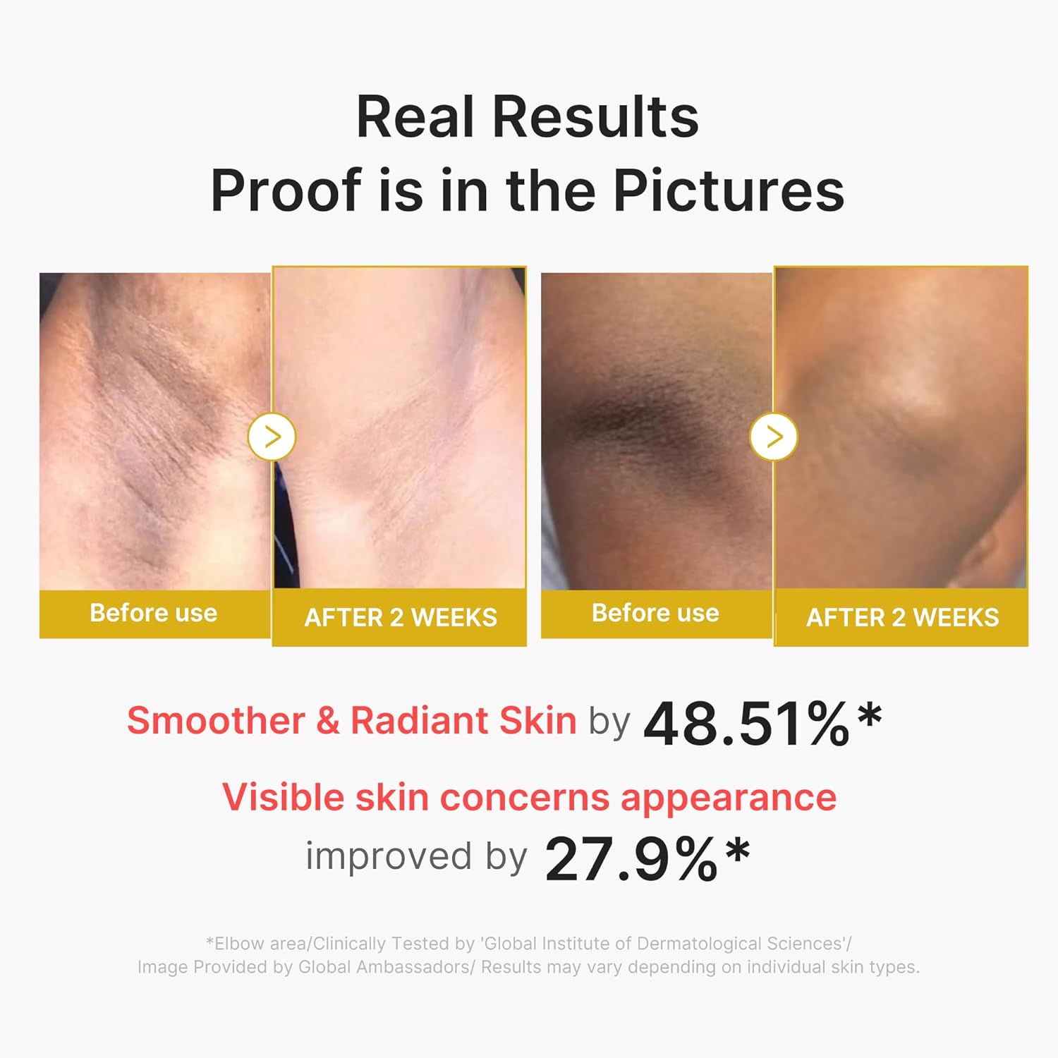 Medicube Body Peel Shot with Kojic Acid and Turmeric - Image 5